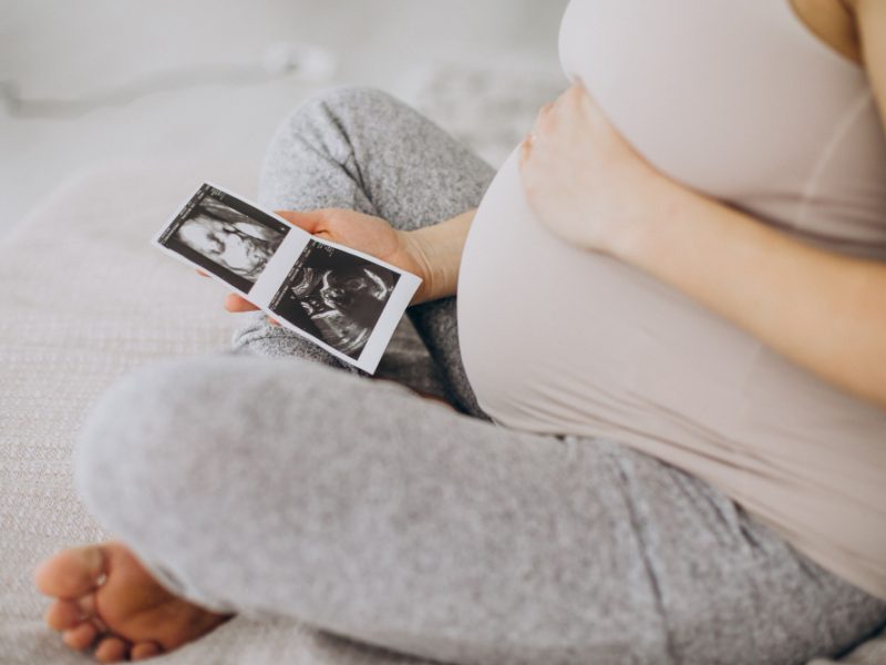 Pregnant Woman With Ultrasound Photo Sitting Bed